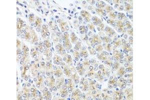 Immunohistochemistry of paraffin-embedded Mouse stomach using MTX1 Polyclonal Antibody at dilution of 1:100 (40x lens).