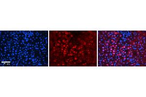 Rabbit Anti-FOS Antibody  AV Formalin Fixed Paraffin Embedded Tissue: Human Liver Tissue Observed Staining: Nucleus in hepatocytes Primary Antibody Concentration: 1:100 Other Working Concentrations: 1:600 Secondary Antibody: Donkey anti-Rabbit-Cy3 Secondary Antibody Concentration: 1:200 Magnification: 20X Exposure Time: 0. (c-FOS Antikörper  (N-Term))