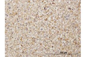 Image no. 1 for anti-Stromal Cell Derived Factor 2 (SDF2) (AA 1-212) antibody (ABIN598919) (SDF2 Antikörper  (AA 1-212))