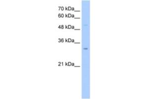 Western Blotting (WB) image for anti-NOP2/Sun Domain Family, Member 5 Pseudogene 2 (NSUN5P2) antibody (ABIN2463242) (NSUN5P2 Antikörper)