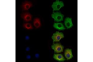 ABIN6262561 and ABIN6278898 staining Hela cells by IF/ICC. (IL28B Antikörper  (Internal Region))
