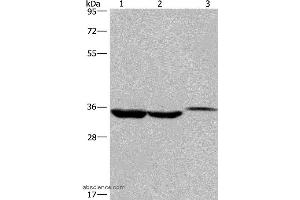 Western blot analysis of Lovo cell,human liver cancer tissue and mouse kidney tissue, using ING2 Polyclonal Antibody at dilution of 1:425 (ING2 Antikörper)