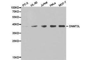 Western Blotting (WB) image for anti-DNA (Cytosine-5-)-Methyltransferase 3 Like (TRDMT1) antibody (ABIN1872332) (DNMT3L Antikörper)