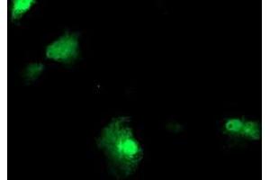 Anti-FBXO21 mouse monoclonal antibody (ABIN2455306) immunofluorescent staining of COS7 cells transiently transfected by pCMV6-ENTRY FBXO21 (RC223095). (FBXO21 Antikörper)