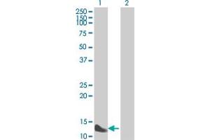 Western Blotting (WB) image for anti-Fatty Acid Binding Protein 1, Liver (FABP1) (AA 1-127) antibody (ABIN515478)