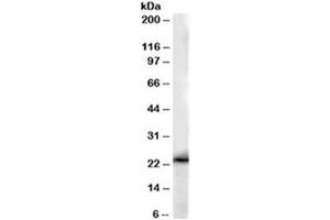 Western blot testing of human kidney lysate with GSTP1 antibody at 0. (GSTP1 Antikörper)