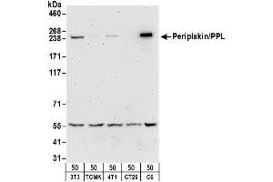 anti-Periplakin (PPL) (AA 1150-1200) antibody