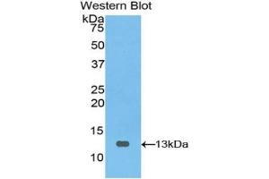 Detection of Recombinant PIGR, Bovine using Polyclonal Antibody to Polymeric Immunoglobulin Receptor (PIGR) (PIGR Antikörper  (AA 461-560))