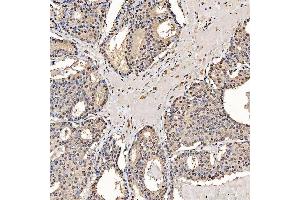 IHC analysis of SART1 using anti-SART1 antibody (ABIN7599884). (SART1 Antikörper  (AA 125-800))