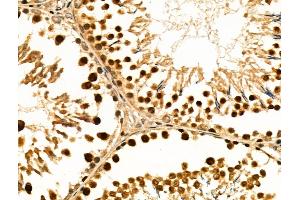 ABIN6258843 and ABIN6274212 at 1/100 staining Rat testis tissue by IHC-P. (HMGB2 Antikörper  (Internal Region))