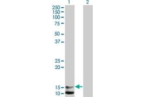 Western Blot analysis of NPPB expression in transfected 293T cell line by NPPB monoclonal antibody (M01), clone 2D11. (NPPB Antikörper  (AA 1-134))