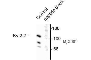 Western blots of rat brain homogenate showing specific immunolabeling of the ~125k voltage-gated potassium channel, Kv2. (Kv2.2 Antikörper)
