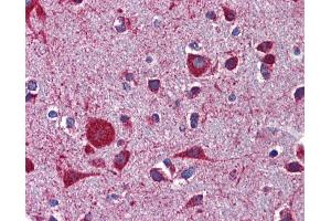 Immunohistochemistry (IHC) image for anti-Low Density Lipoprotein Receptor-Related Protein 8, Apolipoprotein E Receptor (LRP8) (Middle Region) antibody (ABIN2781990)