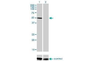 Western blot analysis of ZNF277 over-expressed 293 cell line, cotransfected with ZNF277 Validated Chimera RNAi (Lane 2) or non-transfected control (Lane 1). (ZNF277 Antikörper  (AA 1-278))