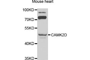 Western blot analysis of extracts of mouse heart, using CAMK2D antibody (ABIN1871415) at 1:1000 dilution. (CAMK2D Antikörper)