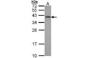 WB Image Sample (30 ug of whole cell lysate) A: Hep G2 , 12% SDS PAGE antibody diluted at 1:1000 (NHEJ1 Antikörper)