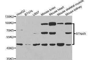 Western blot analysis of extracts of various cell lines, using RTN4R antibody (ABIN5973458) at 1/1000 dilution. (RTN4R Antikörper)