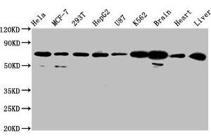 Western Blot Positive WB detected in: Hela whole cell lysate, MCF-7 whole cell lysate, 293T whole cell lysate, HepG2 whole cell lysate, U87 whole cell lysate, K562 whole cell lysate, Rat brain tissue, Mouse heart tissue, Mouse liver tissue All lanes: SLCO2A1 antibody at 2. (SLCO2A1 Antikörper  (AA 416-518))