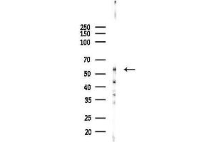 anti-BTB (POZ) Domain Containing 3 (BTBD3) antibody