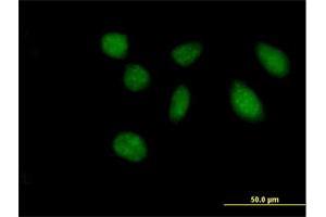 Immunofluorescence of purified MaxPab antibody to FAM47B on HeLa cell. (FAM47B Antikörper  (AA 1-645))