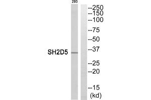 Western blot analysis of extracts from 293 cells, using SH2D5 antibody. (SH2D5 Antikörper  (C-Term))