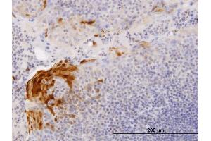 Immunoperoxidase of purified MaxPab antibody to S100A7 on formalin-fixed paraffin-embedded human tonsil. (S100A7 Antikörper  (AA 1-101))