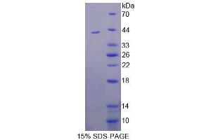 SDS-PAGE analysis of Human CLGN Protein. (Calmegin Protein (CLGN))