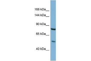 Host:  Rabbit  Target Name:  GALNT5  Sample Type:  COLO205 Whole Cell lysates  Antibody Dilution:  1. (GALNT5 Antikörper  (C-Term))