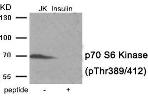 Western blot analysis of extracts from Jurkat cells treated with Insulin using Phospho-p70 S6 Kinase (Thr389/412) antibody.