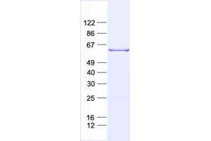 Validation with Western Blot (MMP1 Protein (His tag))