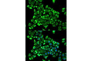 Immunofluorescence (IF) image for anti-Cytidine Deaminase (CDA) antibody (ABIN1871668) (CDA Antikörper)