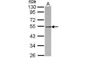 WB Image Sample (30 ug of whole cell lysate) A: Raji 10% SDS PAGE antibody diluted at 1:1000 (DOK1 Antikörper)
