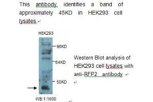 Image no. 1 for anti-Tripartite Motif Containing 13 (TRIM13) antibody (ABIN790828) (TRIM13 Antikörper)