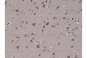 IHC testing of formalin fixed and paraffin embedded human brain tissue with recombinant LC3B antibody at 1:200 dilution. (Rekombinanter LC3B Antikörper  (N-Term))