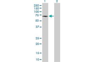 Western Blotting (WB) image for anti-ATPase, H+ Transporting, Lysosomal 56/58kDa, V1 Subunit B1 (ATP6V1B1) (AA 1-513) antibody (ABIN513627)