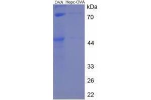 Image no. 1 for Hepcidin Antimicrobial Peptide (HAMP) peptide (Ovalbumin) (ABIN5666217) (Hepcidin Antimicrobial Peptide (HAMP) peptide (Ovalbumin))