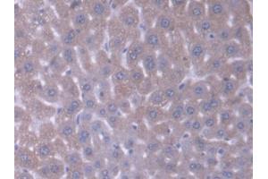 DAB staining on IHC-P; Samples: Mouse Liver Tissue (Acyl-CoA Dehydrogenase, C-4 To C-12 Straight Chain (ACADM) (AA 131-421) Antikörper)