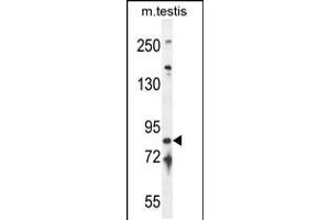 Western blot analysis in mouse testis tissue lysates (35ug/lane). (IFT81 Antikörper  (C-Term))