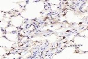 Immunohistochemistry of paraffin embedded mouse lung using F480 (ABIN7073801) at dilution of 1:1000 (400x lens)