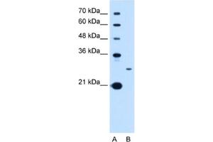 Western Blotting (WB) image for anti-Tetraspanin 15 (TSPAN15) antibody (ABIN2463029) (Tetraspanin 15 Antikörper)