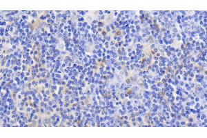 Immunohistochemistry (IHC) image for anti-Lectin, Galactoside-Binding, Soluble, 1 (LGALS1) (AA 1-135) antibody (ABIN7431626)