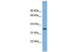PRSS22 antibody used at 1 ug/ml to detect target protein.