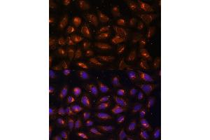 Immunofluorescence (IF) image for anti-Creatine Kinase, Mitochondrial 1B (CKMT1B) (AA 1-85) antibody (ABIN3017246)