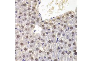 Immunohistochemistry of paraffin-embedded mouse liver using PRDM5 antibody at dilution of 1:100 (x400 lens). (PRDM5 Antikörper)