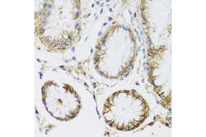 Immunohistochemistry of paraffin-embedded human stomach using ATP1A1 antibody (ABIN5970238) at dilution of 1/100 (40x lens). (ATP1A1 Antikörper)