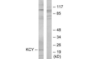 Western blot analysis of extracts from HeLa cells, using KCY antibody. (KCY (N-Term) Antikörper)