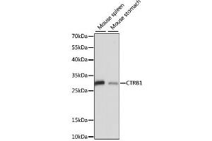 Western blot analysis of extracts of various cell lines, using CTRB1 antibody. (CTRB1 Antikörper)