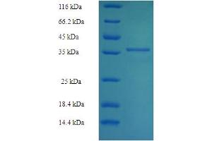 SDS-PAGE (SDS) image for PDZ and LIM Domain 7 (Enigma) (PDLIM7) (AA 185-386) protein (His-SUMO Tag) (ABIN5710742) (PDLIM7 Protein (AA 185-386) (His-SUMO Tag))