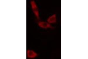 ABIN6266813 staining K-562 cells by IF/ICC. (AGPAT9 Antikörper  (Internal Region))