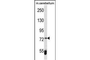 Western blot analysis in mouse cerebellum tissue lysates (35ug/lane). (ZBTB39 Antikörper  (AA 231-258))